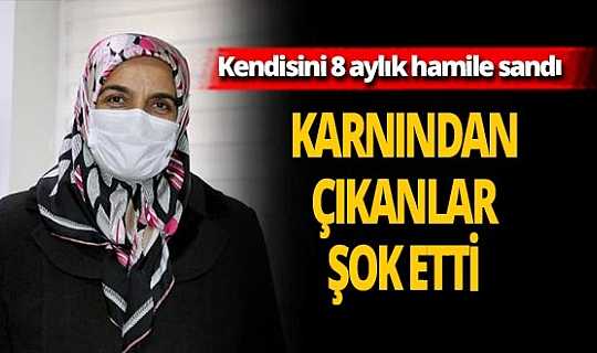 Eskişehir'de gaz şikayetiyle hastaneye gitti karnından çıkanlar doktorları bile şok etti!